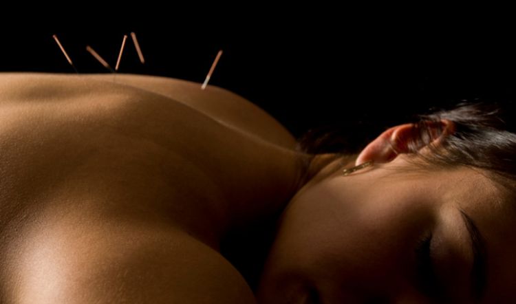 Co Nedelat po Akupunkture?