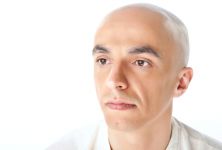 Vypadávání vlasů - alopecie