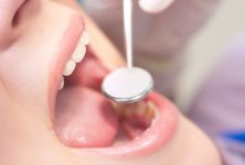 Přehnaná péče o zuby škodí