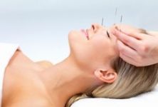 Vyzkoušeli jste už akupunkturu?