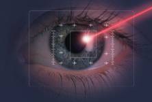 Laserové operace očních vad